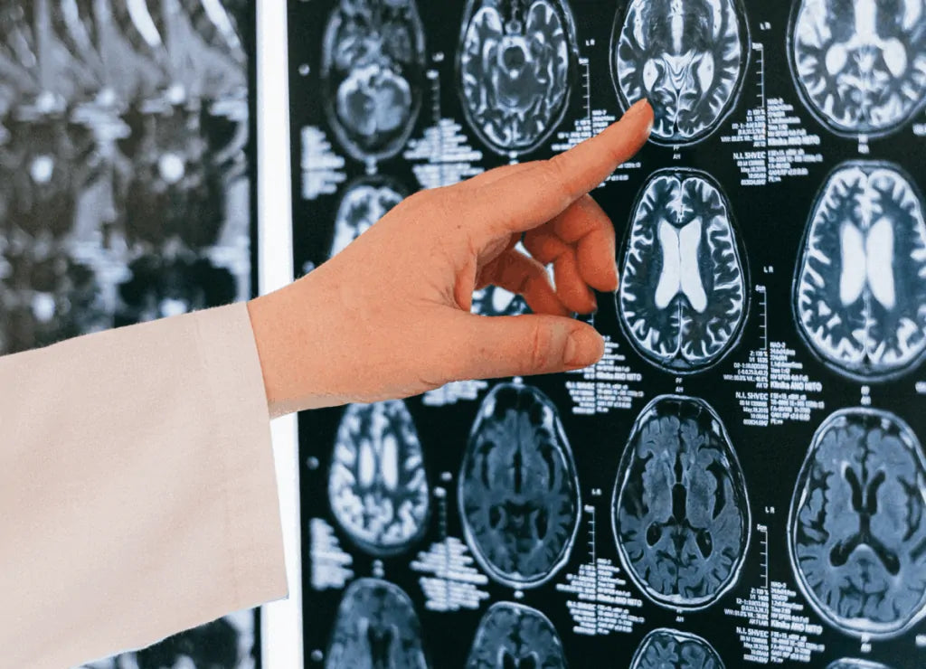 Want to learn more about the neurobiology of mindfulness? Read this!